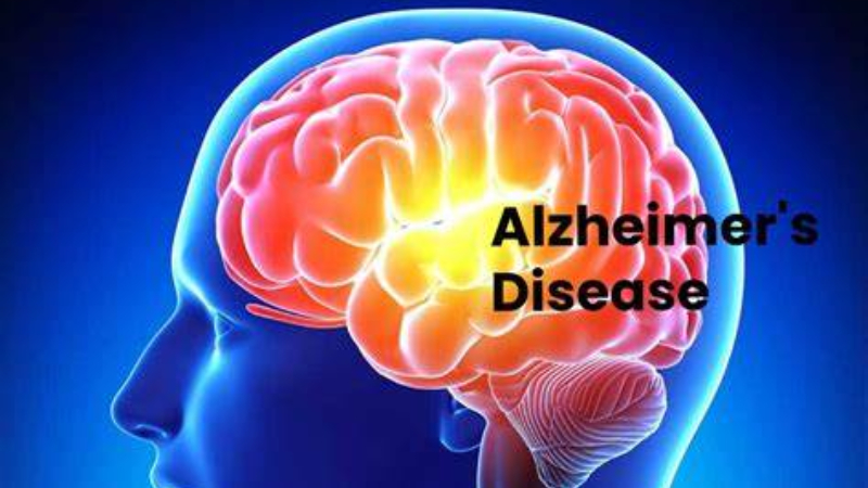 Selenium-enriched foods could be used against Alzheimer's disease: study